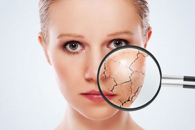 Dermatolog Dr. Buğlem Elgörmüş, kuru cilt hastalıkları hakkında açıklamalarda bulundu ve yaz aylarında güneşe aşırı maruz kalma ve yoğun su temasının kuruluğu artırarak hastalıkları şiddetlendirebileceğini belirtti.