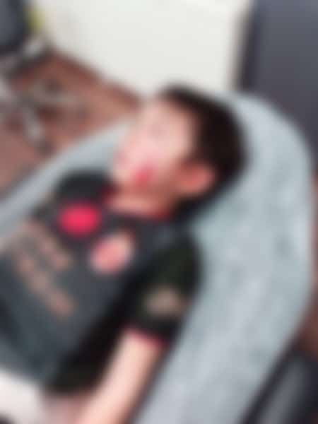 Bandırma Belediye Başkanı Tolga Tosun’un pitbull cinsi köpeği, 8 yaşındaki B.P.’nin yüzünü parçaladı. Vatandaşların yardımıyla ölümden son anda kurtulan minik çocuğun yüzüne 20 dikiş atıldı.