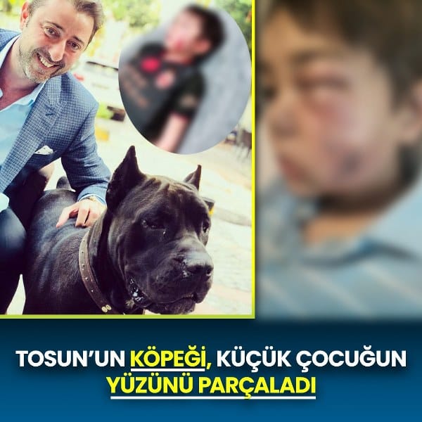 Başkan Tosun’un köpeği çocuğun yüzünü parçaladı